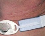 HOLDER, TRACH TUBE NEO (10/BX10BX/CS)                CARFUS