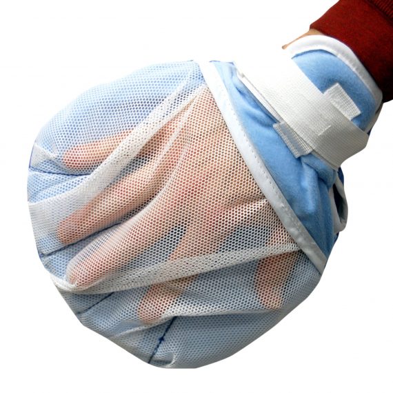 MITT, FINGER SEPARATORSKLCRE